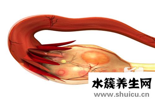 卵巢增大