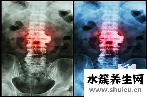 脊柱梳理