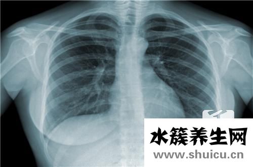 结核病防治知识