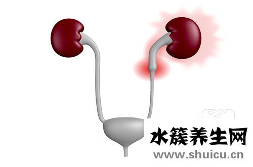 狼疮肾