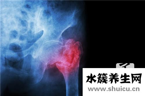 如何治疗盆腔炎