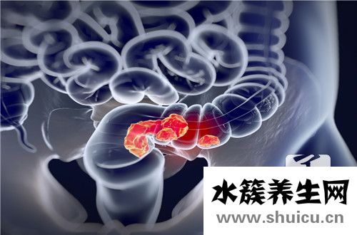 直肠癌术后