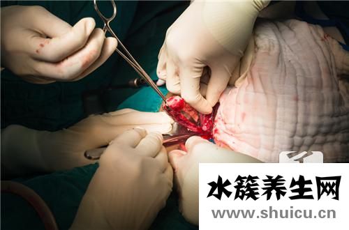 血性腹水