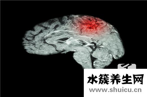 脑垂体肿瘤