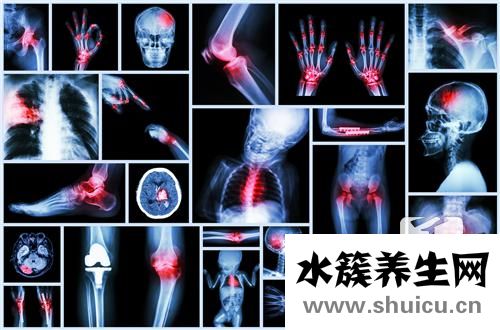 骨折愈合时间