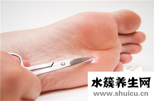 儿童传染性软疣