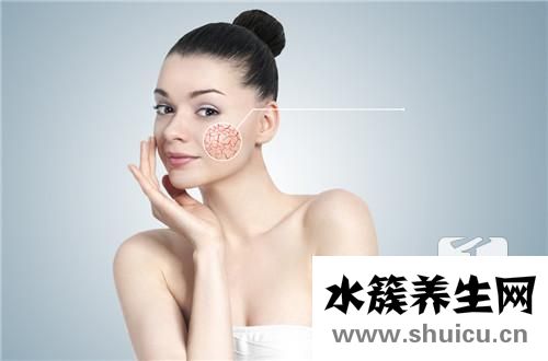溢脂性皮炎的症状