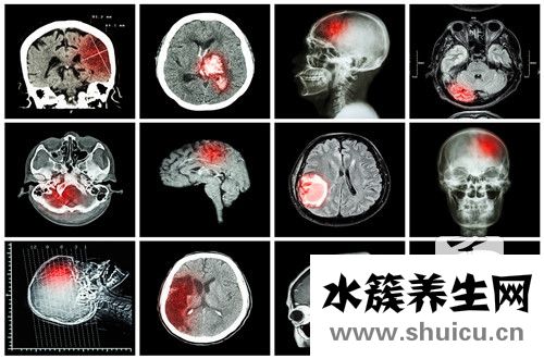 口服甘露醇