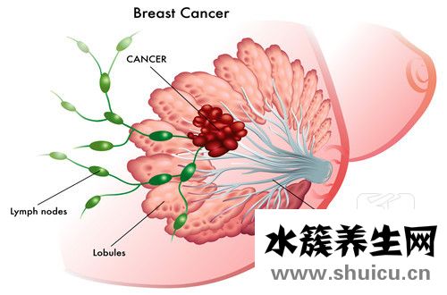 乳腺小叶增生怎么冶疗？