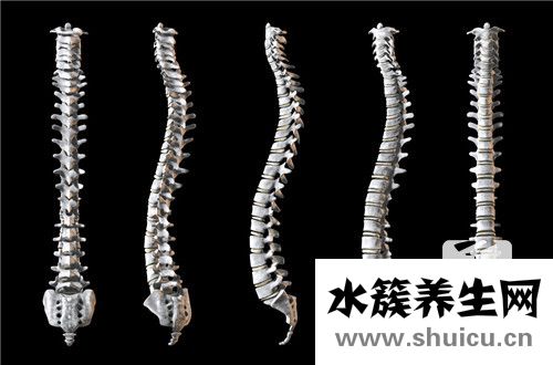 脊髓灰质炎后遗症