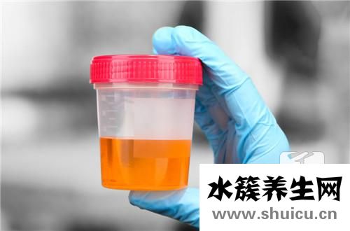 尿素氮偏高的原因