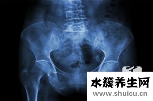 盆腔包块