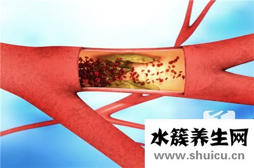 神经症的主要症状有