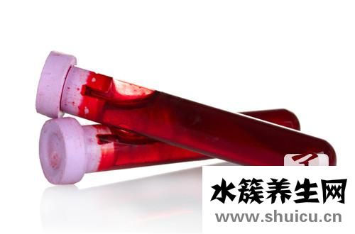 血清尿酸