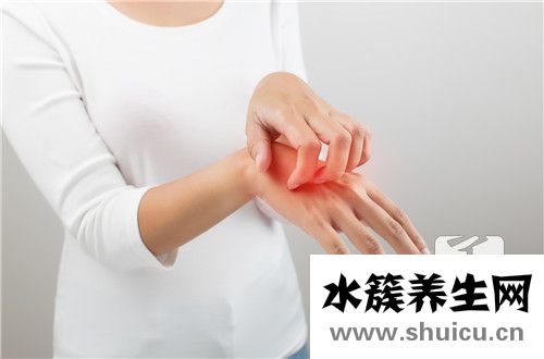 脂溢性皮炎能治好吗