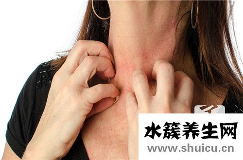 炎症介质