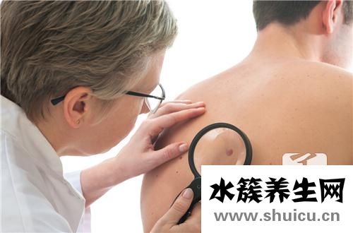 点痣的危害