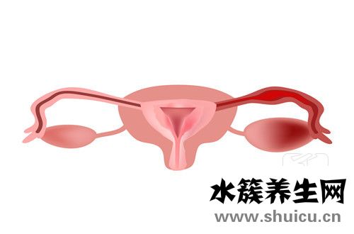 穿刺手术