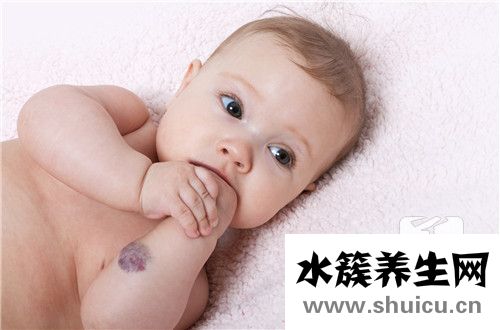 什么是血管瘤