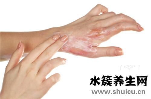 伤口痒
