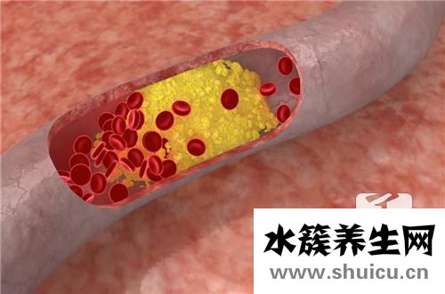 糖尿病有哪些症状
