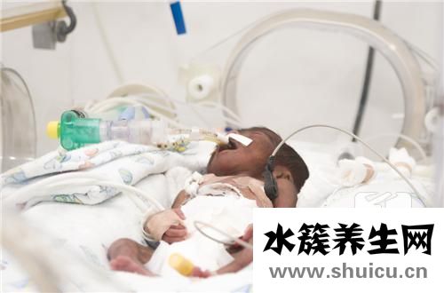 新生儿病理性黄疸
