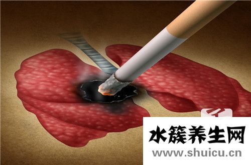 神经胶质瘤