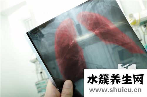 肺炎支原体抗体