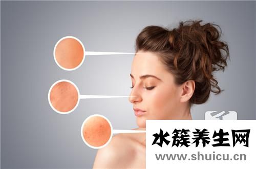 蛇盘疮最佳治疗方法