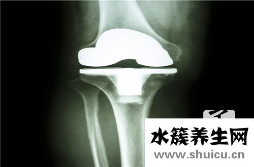 胫骨结节骨骺炎