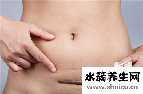 伤口愈合
