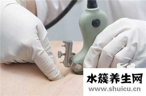 羊水深度