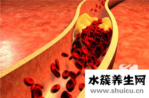 血小板计数偏高