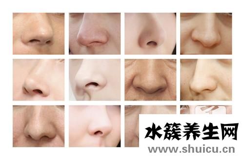 鼻窦炎怎么治疗