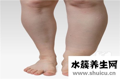 胖女人水多是什么原因？