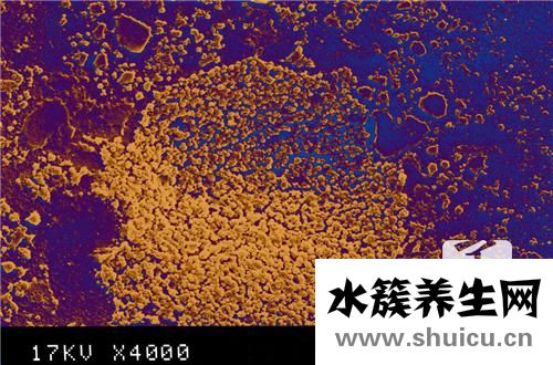 肺炎支原体阳性