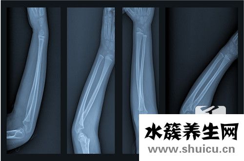 桡骨