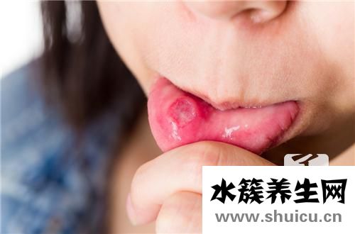 水疱