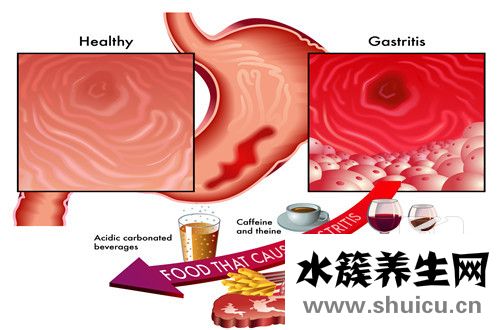 胃胀怎么办