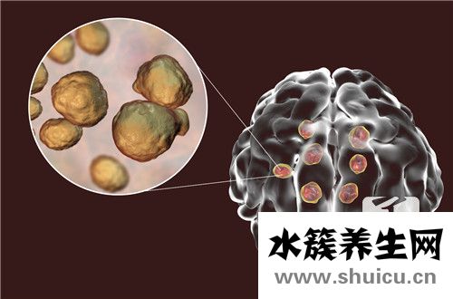 脑膜炎症状