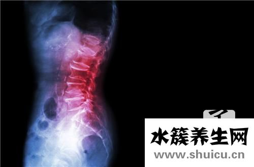 硬膜囊