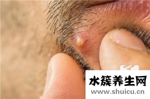 眼角内长了个小白脓点