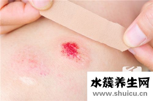 为什么年轻人一般不要贴膏药？