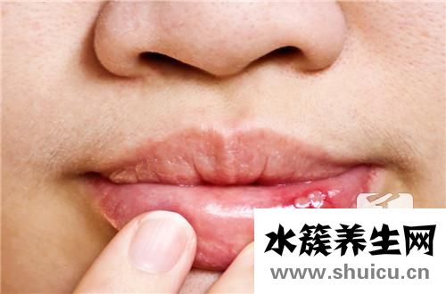 溃疡的白色刮掉会怎样