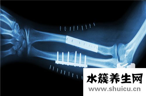 横突骨折一个月能好吗