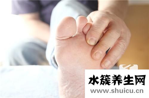 手藓怎么治