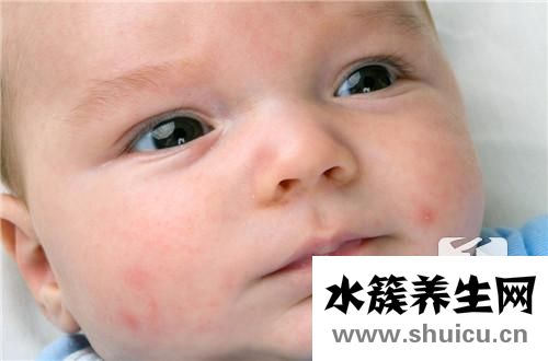 宝宝身上长了很多小红点
