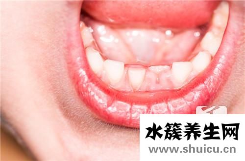 小孩牙齿没掉又长出新牙怎么办