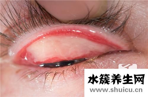 小孩子眨眼睛