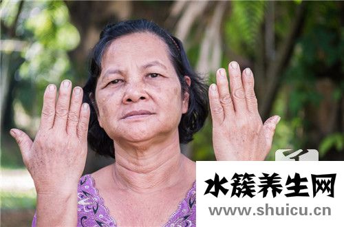 老年斑治疗方法